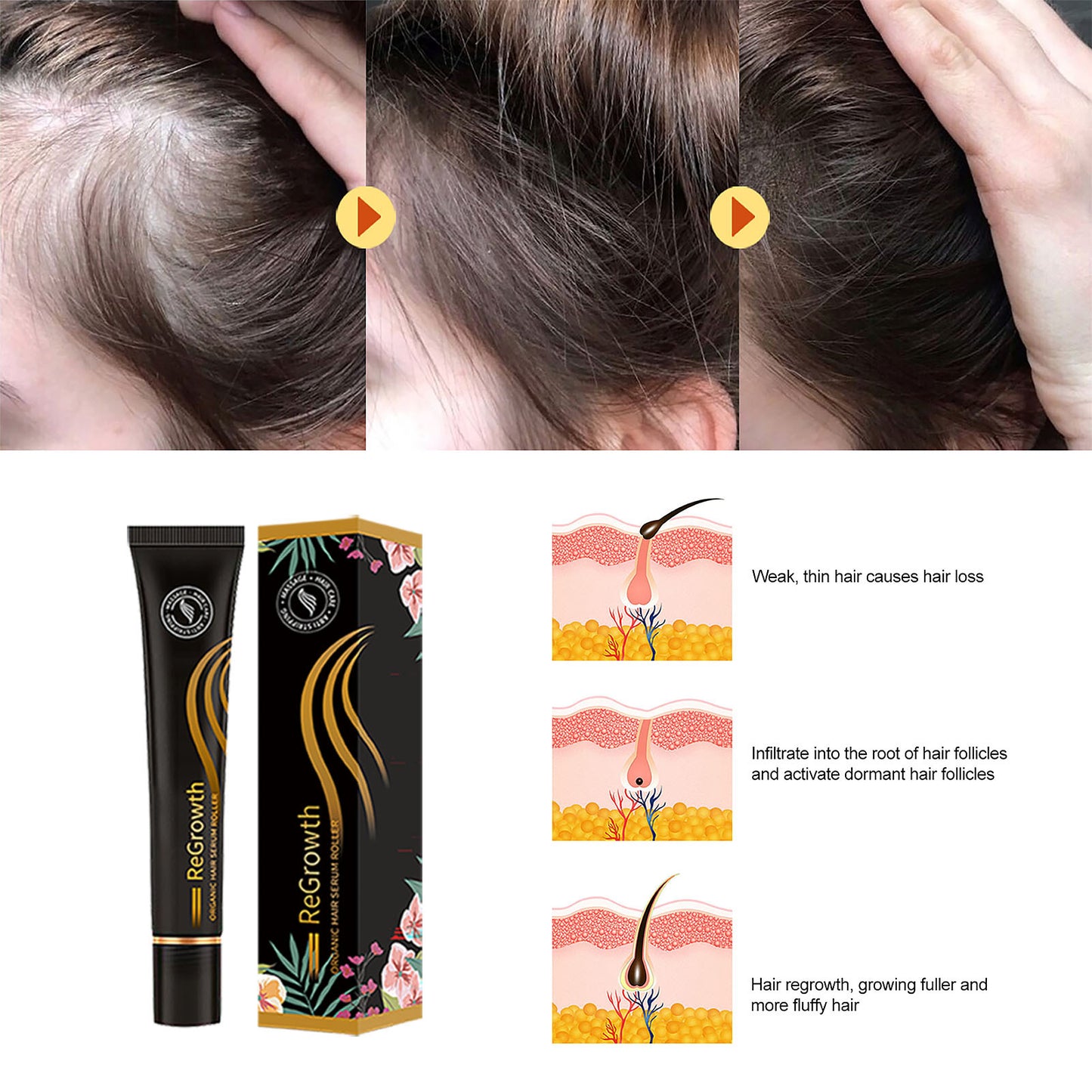 Organic Hair Regrowth Serum Roller Set