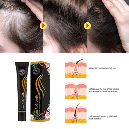 Organic Hair Regrowth Serum Roller Set