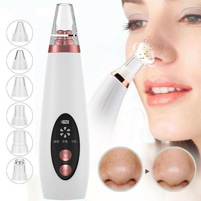 Blackhead Vacuum Pore Cleaner