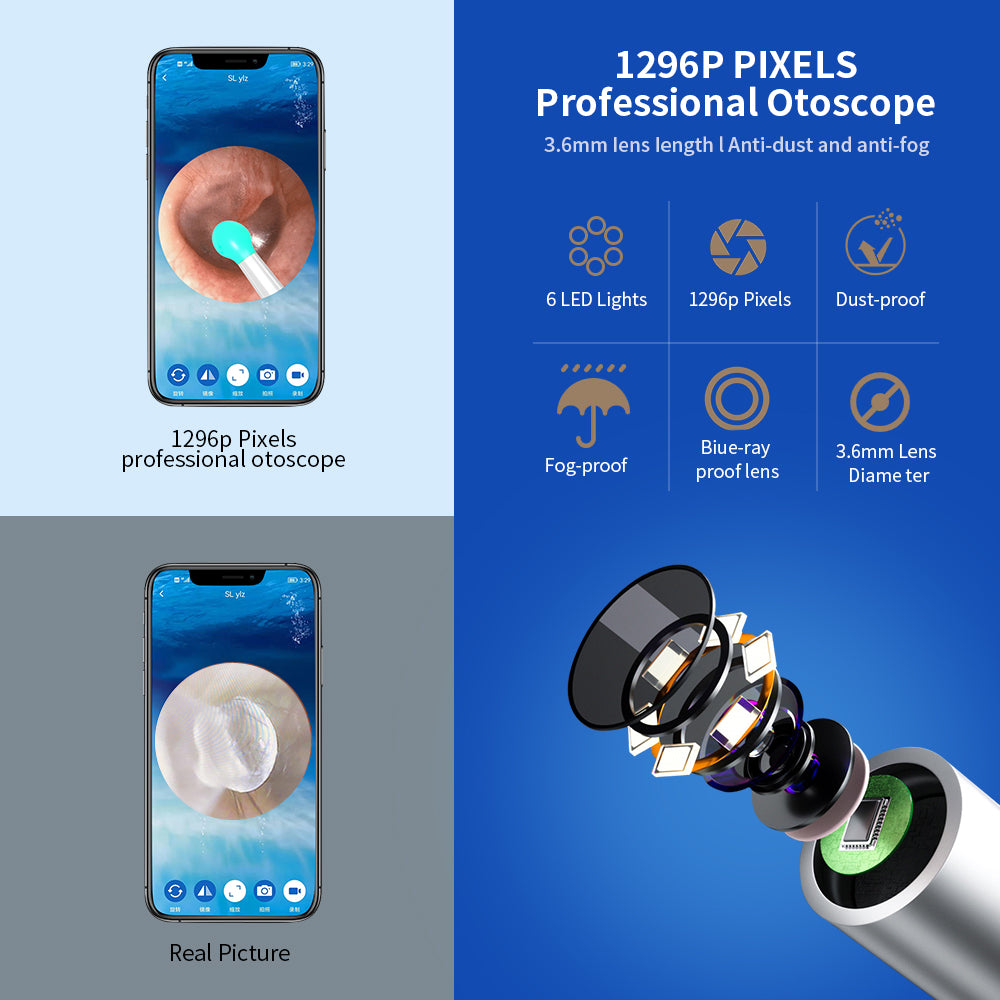 Wireless NE3 Ear Cleaner Otoscope with LED Camera for iPhone